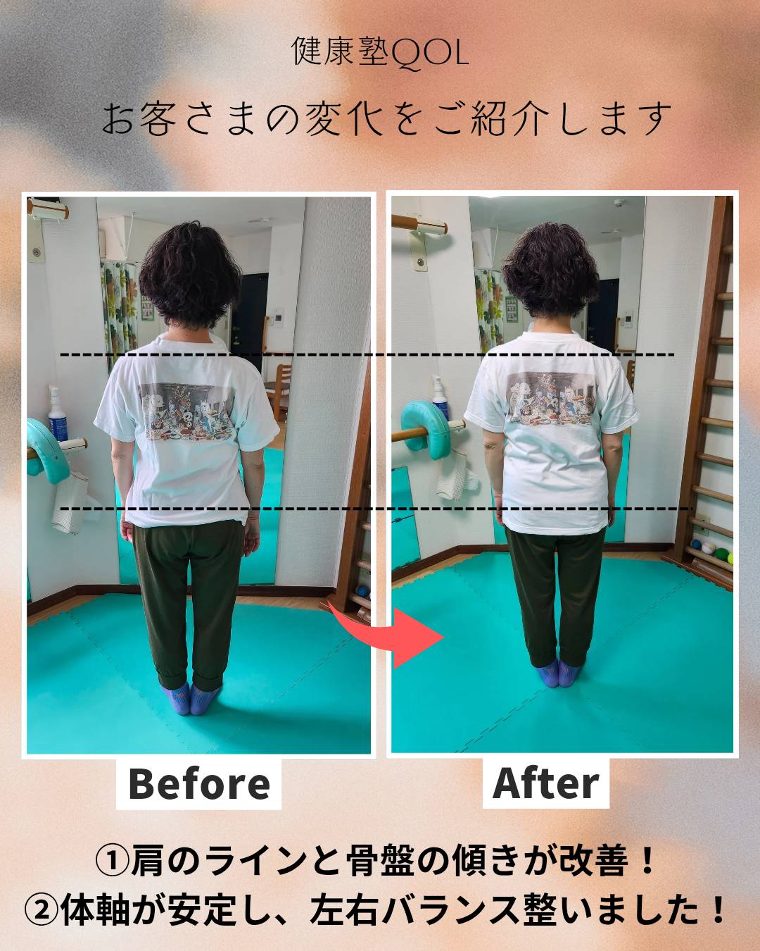 ビフォーアフター